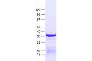 Validation with Western Blot (UTP11L Protein (His tag))