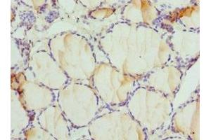 Immunohistochemistry of paraffin-embedded human thyroid tissue using ABIN7149983 at dilution of 1:100 (DPP3 anticorps  (AA 1-280))