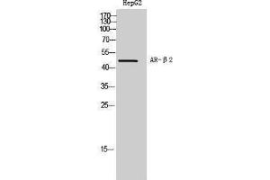 Western Blotting (WB) image for anti-Androgen Receptor beta 2 (C-Term) antibody (ABIN3183393) (Androgen Receptor beta 2 anticorps  (C-Term))