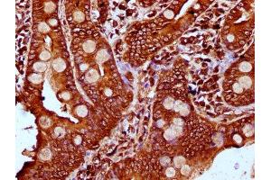 IHC image of ABIN7163552 diluted at 1:400 and staining in paraffin-embedded human small intestine tissue performed on a Leica BondTM system.