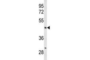 Western blot analysis of ANGPTL4 antibody and mouse liver tissue lysate.