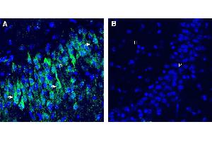 Expression of CD9 in mouse hippocampus. (CD9 anticorps  (Extracellular))