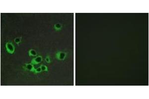 Immunofluorescence analysis of COS7 cells, using HTR2B Antibody. (Serotonin Receptor 2B anticorps  (AA 15-64))