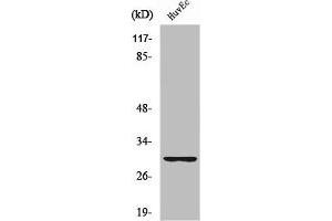 Western Blot analysis of HuvEc cells using Ribosomal Protein S4Y1 Polyclonal Antibody (RPS4Y1 anticorps  (C-Term))