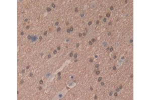 Used in DAB staining on fromalin fixed paraffin- embedded brain tissue (RNASEH2A anticorps  (AA 1-299))
