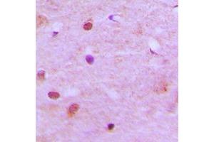 anti-Regulator of Chromosome Condensation 2 (RCC2) (C-Term) antibody