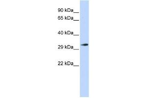 WB Suggested Anti-FHL1 Antibody Titration: 0.