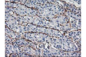 Image no. 2 for anti-Low Density Lipoprotein Receptor Adaptor Protein 1 (LDLRAP1) antibody (ABIN1496685) (LDLRAP1 anticorps)