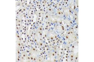 Immunohistochemistry of paraffin-embedded mouse kidney using SF3B3/S Rabbit mAb (ABIN7270544) at dilution of 1:100 (40x lens). (SF3B3 anticorps)