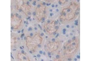 Used in DAB staining on fromalin fixed paraffin- embedded Kidney tissue (Nicotinamide Adenine Dinucleotide Phosphate Oxidase 3 (AA 221-466) anticorps)
