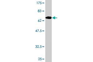Western Blot detection against Immunogen (69. (ADRM1 anticorps  (AA 18-407))