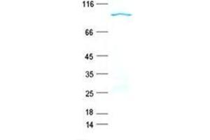 Validation with Western Blot