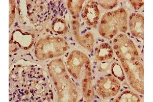 Immunohistochemistry of paraffin-embedded human kidney tissue using ABIN7143116 at dilution of 1:100