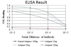 Red: Control Antigen (100 ng), Purple: Antigen (10 ng), Green: Antigen (50 ng), Blue: Antigen (100 ng),