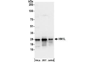 anti-Hematological and Neurological Expressed 1-Like (HN1L) (AA 50-100) antibody