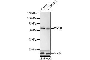 Western blot analysis of extracts from normal (control) and SYVN1 knockout (KO) 293T cells, using SYVN1 antibody (ABIN1680347, ABIN3016314, ABIN3016315 and ABIN6219717) at 1:1000 dilution. (SYVN1 anticorps  (C-Term))