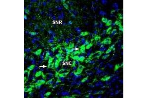 Expression of TRPM2 in rat substantia nigra - Immunohistochemical staining of perfusion-fixed frozen rat brain sections with Anti-TRPM2 (extracellular) Antibody (ABIN7043831, ABIN7044075 and ABIN7044076), followed by goat anti-rabbit-AlexaFluor-488.
