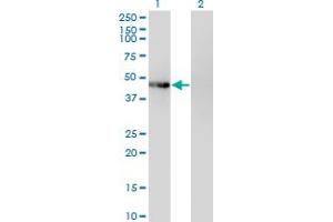 Western Blot analysis of PHKG2 expression in transfected 293T cell line by PHKG2 monoclonal antibody (M04), clone 2F4. (PHKG2 anticorps  (AA 1-406))