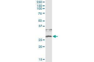 Immunoprecipitation of CD79B transfected lysate using anti-CD79B monoclonal antibody and Protein A Magnetic Bead , and immunoblotted with CD79B MaxPab rabbit polyclonal antibody.