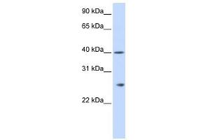 GSTK1 antibody used at 1 ug/ml to detect target protein. (GSTK1 anticorps  (N-Term))