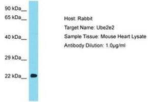 Image no. 1 for anti-Ubiquitin-Conjugating Enzyme E2E 2 (UBE2E2) (N-Term) antibody (ABIN6750311) (UBE2E2 anticorps  (N-Term))