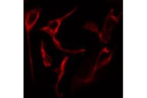 ABIN6267521 staining Hela cells by IF/ICC.
