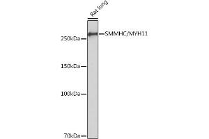 Western blot analysis of extracts of Rat lung, using SMMHC/SMMHC/MYH11 Rabbit mAb (ABIN7268745) at 1:1000 dilution. (MYH11 anticorps)