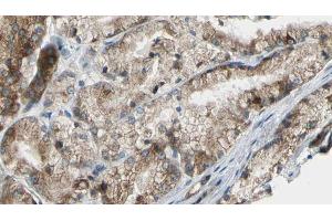 ABIN6272607 at 1/100 staining Human prostate tissue by IHC-P. (PIK3C2G anticorps  (C-Term))