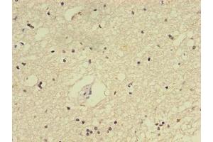Immunohistochemistry of paraffin-embedded human brain tissue using ABIN7172517 at dilution of 1:100
