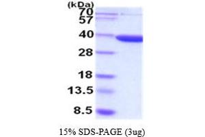 SDS-PAGE (SDS) image for Aldo-Keto Reductase Family 7, Member A3 (Aflatoxin Aldehyde Reductase) (AKR7A3) (AA 1-331) (Active) protein (ABIN5854494)