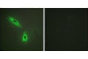 Immunofluorescence analysis of HeLa cells, using TNFC Antibody. (LTB anticorps  (AA 181-230))