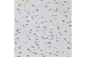 Immunohistochemistry of paraffin-embedded rat brain using PRPF3 Antibody. (PRPF3 anticorps  (AA 1-280))