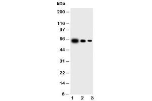 Western blot testing of IL23 p19 antibody and Lane 1:  recombinant mouse protein 10ng (IL23A anticorps  (N-Term))