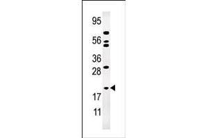 Western blot analysis of anti-AK1 Pab (ABIN392794 and ABIN2842231) in Jurkat cell line lysate (35 μg/lane).