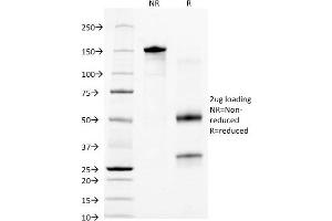 SDS-PAGE Analysis of Purified CKRT18 Mouse Monoclonal Antibody ABIN6383865.