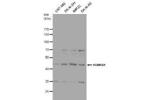 WB Image Homer antibody detects Homer protein by western blot analysis.