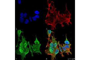 Immunocytochemistry/Immunofluorescence analysis using Mouse Anti-Ankyrin B Monoclonal Antibody, Clone S105-13 . (ANK2 anticorps  (AA 203-496) (APC))