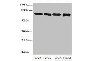 Western blot All lanes: Protein-arginine deiminase type-2 antibody at 16 μg/mL Lane 1: PC-3 whole cell lysate Lane 2: Hela whole cell lysate Lane 3: Mouse brain tissue Lane 4: MDA-MB-231 whole cell lysate Secondary Goat polyclonal to rabbit IgG at 1/10000 dilution Predicted band size: 76, 50 kDa Observed band size: 76 kDa