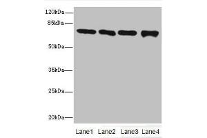 Western blot All lanes: Protein-arginine deiminase type-2 antibody at 16 μg/mL Lane 1: PC-3 whole cell lysate Lane 2: Hela whole cell lysate Lane 3: Mouse brain tissue Lane 4: MDA-MB-231 whole cell lysate Secondary Goat polyclonal to rabbit IgG at 1/10000 dilution Predicted band size: 76, 50 kDa Observed band size: 76 kDa (PADI2 anticorps  (AA 1-665))