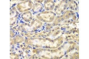 Immunohistochemistry of paraffin-embedded Mouse kidney using Myelin Basic protein Polyclonal Antibody at dilution of 1:200 (40x lens). (MBP anticorps)