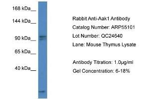 Western Blotting (WB) image for anti-AP2 associated kinase 1 (AAK1) (C-Term) antibody (ABIN2786056) (AAK1 anticorps  (C-Term))
