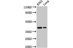 Western Blot Positive WB detected in: K562 whole cell lysate, Rat lung tissue All lanes: PTX3 antibody at 2 μg/mL Secondary Goat polyclonal to rabbit IgG at 1/50000 dilution Predicted band size: 42 kDa Observed band size: 42 kDa (PTX3 anticorps  (AA 99-164))