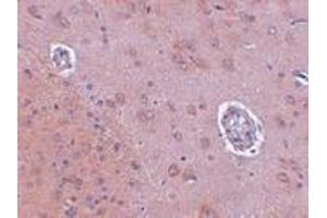 Immunohistochemistry (IHC) image for anti-Family with Sequence Similarity 120A (FAM120A) (Middle Region) antibody (ABIN1030930) (FAM120A anticorps  (Middle Region))
