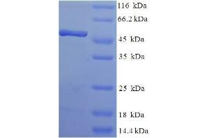 SDS-PAGE (SDS) image for Transcription Elongation Factor A2 (TCEA2) (AA 1-299), (full length) protein (His-SUMO Tag) (ABIN5711299)