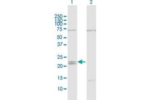 Western Blot analysis of IFNE1 expression in transfected 293T cell line by IFNE1 MaxPab polyclonal antibody. (IFNE anticorps  (AA 1-208))