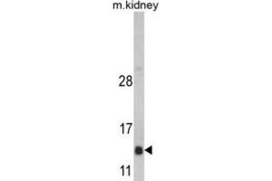 Western Blotting (WB) image for anti-DnaJ (Hsp40) Homolog, Subfamily C, Member 19 (DNAJC19) antibody (ABIN3002676) (DNAJC19 anticorps)