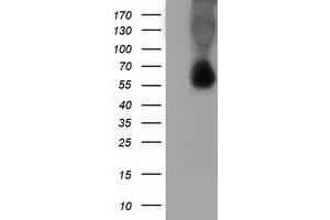 Image no. 5 for anti-Sequestosome 1 (SQSTM1) antibody (ABIN1499990) (SQSTM1 anticorps)