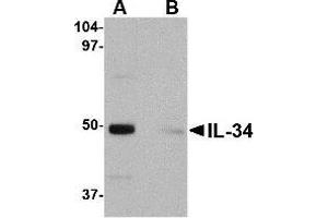 Western blot analysis of IL-34 in human brain tissue lysate with IL-34 antibody at 0.