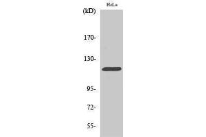Western Blotting (WB) image for anti-Cas-Br-M (Murine) Ecotropic Retroviral Transforming Sequence (CBL) (Ser207) antibody (ABIN3183701)