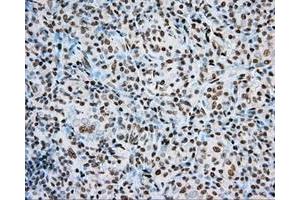 Immunohistochemical staining of paraffin-embedded Kidney tissue using anti-ARNT mouse monoclonal antibody. (ARNT anticorps)